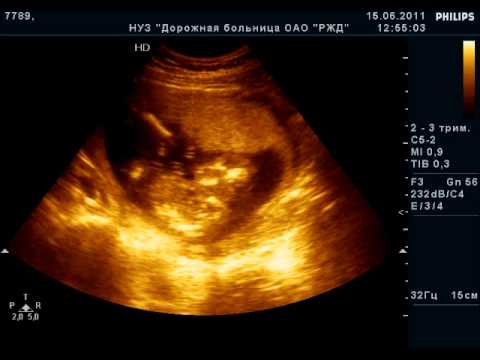 Стоматологическая поликлиника на самарской сайт