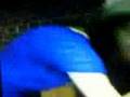 CPR mouth to mouth D it had nipples
