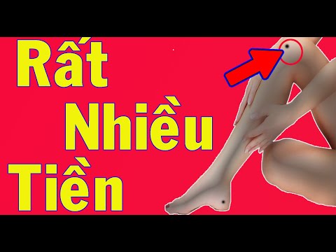 Xem Tài Vận Tình Duyên Tài Lộc Qua Nốt Ruồi
