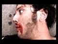 Botch - Episode 1 - La Kryptonite