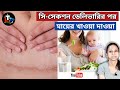 Diet After C Section Delivery in Bengali || mother diet after cesarean delivery in bengali