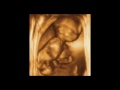Jeniffer Baby 16 Weeks 3D 4D Ultrasound -3D 4D Ultrasound Video