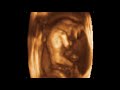 ultrasound 3d 4d