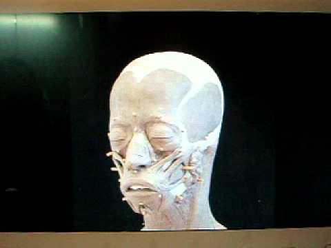 Myrtis, an athenian girl who lived 2,500 years ago.