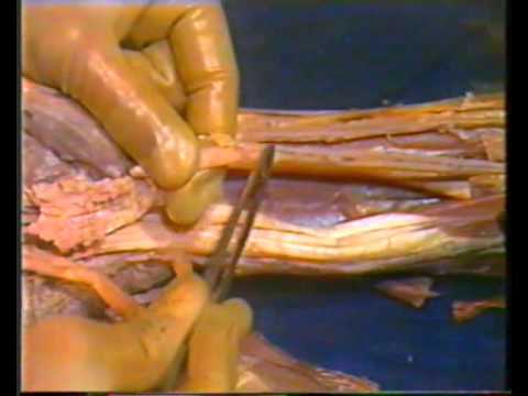 Human Anatomy - Upper Limb - YouTube