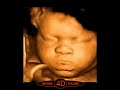 ultrasound 3d 4d