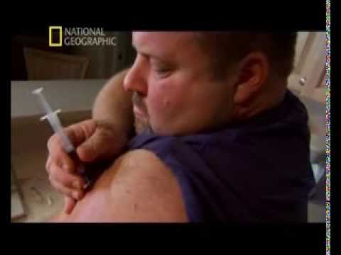 Anabolic steroids national geographic