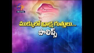 Nasal Polyps | Sukhibhava | 16th November 2018 | ETV Telangana