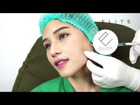 botox กราม เห็นผลใน 2 สัปดาห์ ออกฤทธิ์นาน 4-6 เดือน อยากหน้าเรียว ปรึกษาอีลิทคลินิก ลาดพร้าว 24