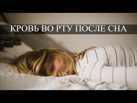 Сон Кровь После Секса