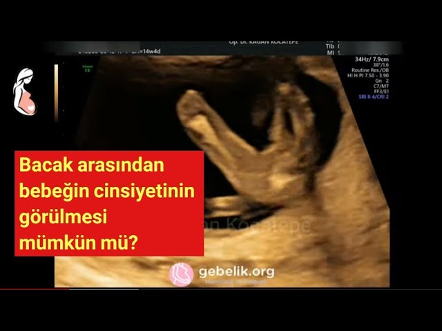 15. gebelik haftasında cinsiyet görülebilir mi? Kız veya erkek anlaşılabilir mi? Cinsiyet belirlemek