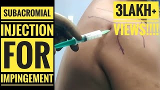 Subacromial Injection For Shoulder Impingement