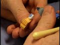 Restoring a tooth (CAD-CAM Ceramic) - Part 2