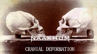 Watch Naakhum Cranial Deformation video