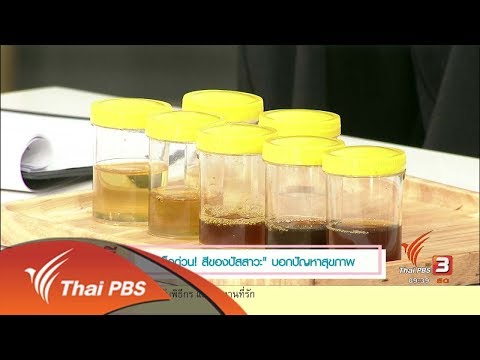 นารีสนทนา : สีของปัสสาวะ บอกปัญหาสุขภาพ (28 ส.ค. 60)