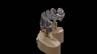 B4D Crown Module