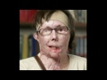 Face transplant for woman in vicious attack