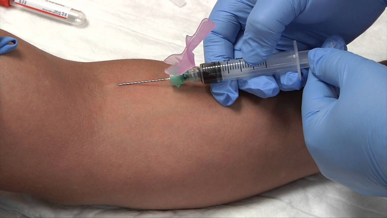 Phlebotomy Syringe Draw Procedure Youtube