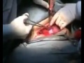 Delivery Operation.flv