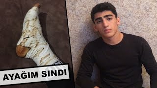 Ayağim Sindi