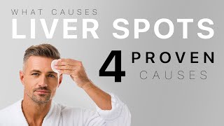 What Causes Liver Spots? 4 Proven Causes