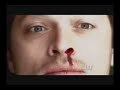 Dean/Cas Set Fire to the Rain