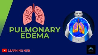 Pulmonary Edema Causes, Symptoms, And Treatment
