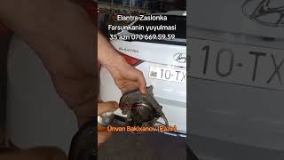 Yüksək Teyziqli Və Sade Farsunkalarin Yuyulub Stent Olunmasi Ünvanbakixanov Tel070 669 59 59