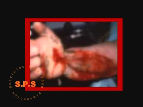 Watch Primeros auxilios quemaduras - S.P.S Nº 240