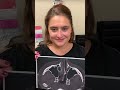Sinus Surgery/Septoplasty 5 days ago and comfortable