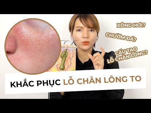 KHẮC PHỤC LỖ CHÂN LÔNG TO - Đầy đủ kiến thức từ cấu trúc, cách khắc phục, sai lầm thường gặp.