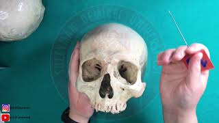 Cranium Bütünü Ve Fossalar 1 Kafa İskeleti Bütünü