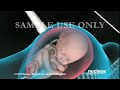 AMAZING 3D Medical Animation: Nucleus Obstetrics and Gynecology Demo