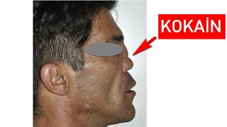 Kokai̇n Kullanan Nasil Anlaşilir ?