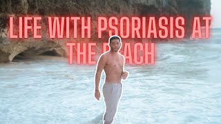 Life With Psoriasis At The Beach Victor Zara