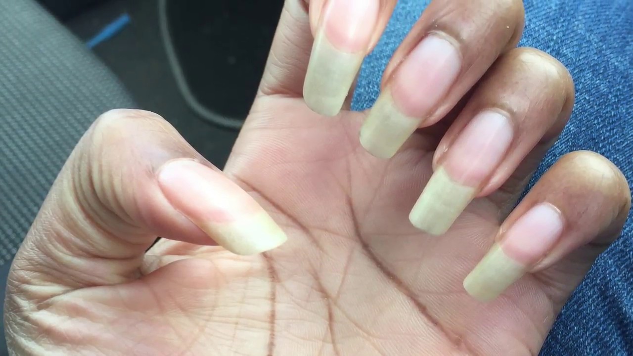 Sharp nails scratching skin