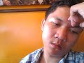 image Keajaiban Dunia Matanya Bisa Copot