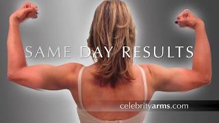 Celebrity Armsliposuction Lipo 360 Arms High-Definition Ultra-Complete Expert Dr. Thomas Su