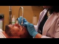 HydraFacial Skin Treatment at Paramount Plastic Surgery- Keith Jeffords, MD