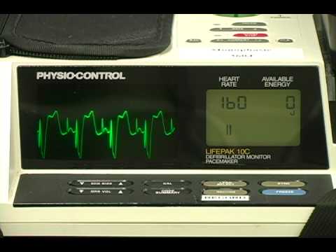 Tachycardia Algorithm Acls. NET ACLS PALS CPR NPR IV