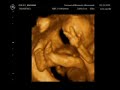 Baby Cedano 4D Ultrasound Part 1.mp4