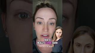 The Absolute Worst Method For Banishing Age Spots
