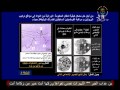 مقر تركيب البروتين