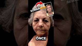 Yaşlı Kadının Yüzü Gençleşti Son Hali Şok Etti̇