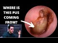 Something Is Very Wrong With This Ear...... (Differential Diagnosis)