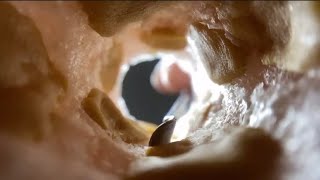 Asmr Ear Cleaning Limpeza De Ouvido Asmr