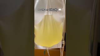 See What Cloudy Peritoneal Dialysis Effluent Looks Like