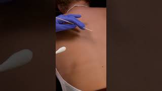 Asmr Real Person Back Inspection