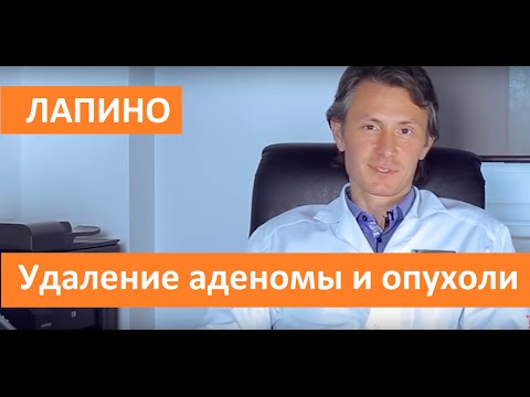 Удаление аденомы и опухоли. ГК Мать и дитя Удаление аденомы и опухоли. ГК Мать и дитя