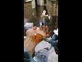 Draining a large blister from trampoline dodgeball burn